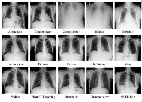 Radiography Student, Radiology Schools, Medical Radiography, Radiology Humor, Radiology Student, Radiology Technician, Radiology Imaging, Nursing School Essential, Medical School Life