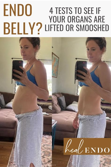 If you have a big endo belly lower belly pooch, check for core dysfunction! It may be a visual of your organs being pushed down thanks to poor core function. Learn how to lift them back up, rather than sucking in! #endometriosis #endobelly #endometriosisbloat #endodiet What Causes Lower Belly Pooch, Why Do I Have A Lower Belly Pooch, Endo Belly Diet, Supplements For Endo, Core Dysfunction Exercises, Endo Belly Pictures, Dressing With A Belly Pooch, Gluten Belly Before And After, Distended Abdomen Women