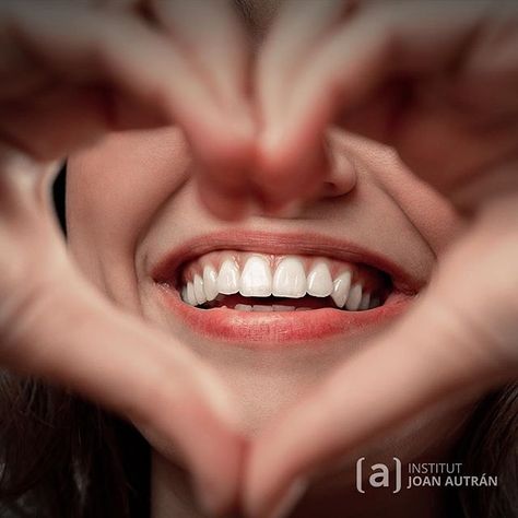 Toda historia de amor comienza con una sonrisa... Feliz San Valentín!  . . . . . .  #doctorjoanautran #institutautran #esteticadental #sanvalentin #carillasdentales #carillasdeporcelana #smiledesign #barcelona #santcugat #diseñodesonrisa #clinicadental #odontologo #newsmile #sonrisas #estheticdentistry #veneers #dentistrymyworld #dentalart #powerofporcelain #topdoctors #dsd #love Whiten Teeth Naturally, Whiten Teeth, Instagram