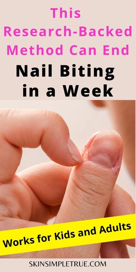 Struggling with nail biting? Discover 13 proven tips and remedies to break the habit fast! Perfect for both kids and adults. Say goodbye to those nibbled nails and hello to healthy hands. #NailBiting #HealthyHabits #SelfCare #NailCare #Wellness How To Quit Biting Your Nails, Picking Skin Around Nails, Tips For Nail Biters, Nail Picking Habit, Nail Ideas For Bitten Nails, Nail Biting Aesthetic, How To Stop Nail Biting Habit, Stop Nail Biting Diy, Nail Biting Remedies For Kids