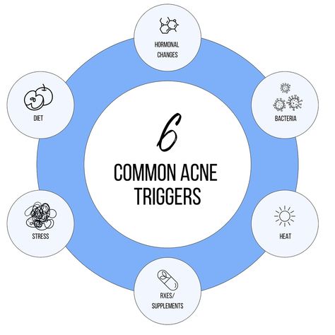 6 common acne triggers. ✨ #ahaa #ahaaskincare #acne #skincaretips Acne Triggers, Hormonal Changes, Skin Care Tips, Acne, Diet, Quick Saves