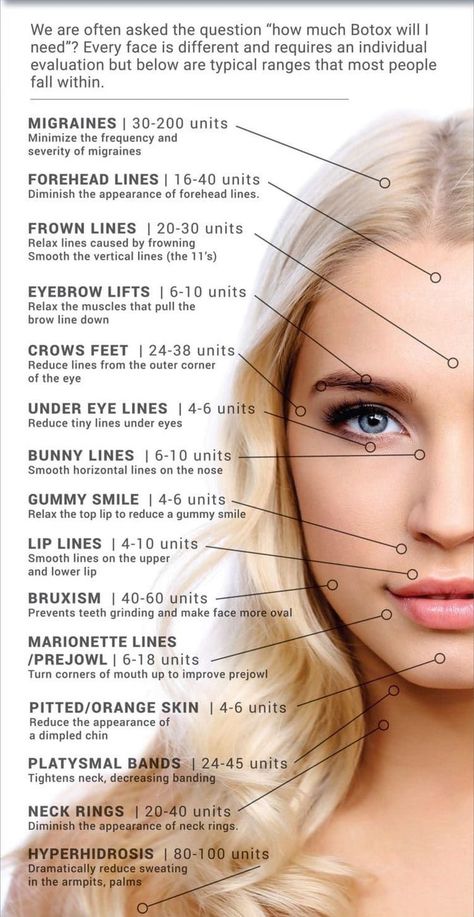 Botox Units, Facial Swelling, Aesthetic Nursing, Botox Injection Sites, Under Eye Lines, Cosmetic Nurse, Facial Injections, Botox Facial, Derma Fillers