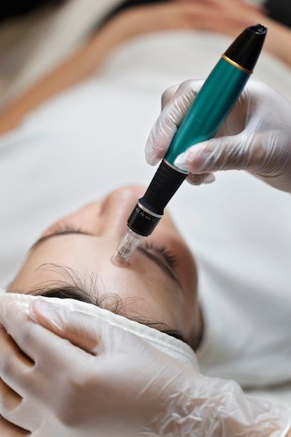 Free photo person getting micro needling... | Free Photo #Freepik #freephoto #microneedling #collagen #cosmetics-collagen #cosmetics-beauty Beauty Stock Photos, Microneedling Video, Micronidelling Face, Microneedling Aesthetic, Esthetics Photos, Dermapen Microneedling, Facial Pictures, Remove Skin Tags Naturally, Skin Needling