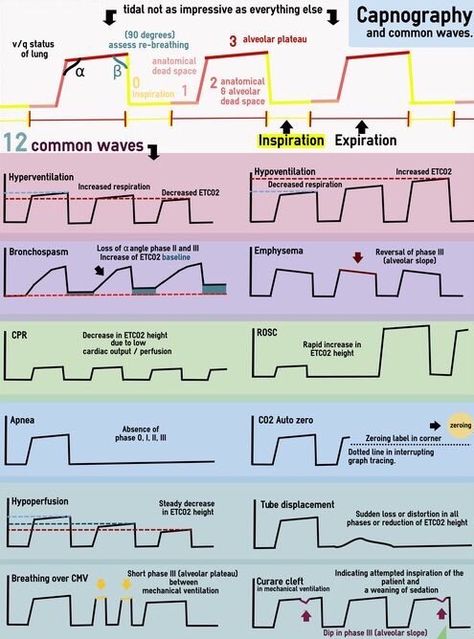 Capnography waveforms Respiratory Therapy Notes, Respiratory Therapist Student, Anesthesia School, Respiratory Therapy Student, Nurse Anesthesia, Paramedic School, Airway Management, Nurse Anesthetist, Mechanical Ventilation