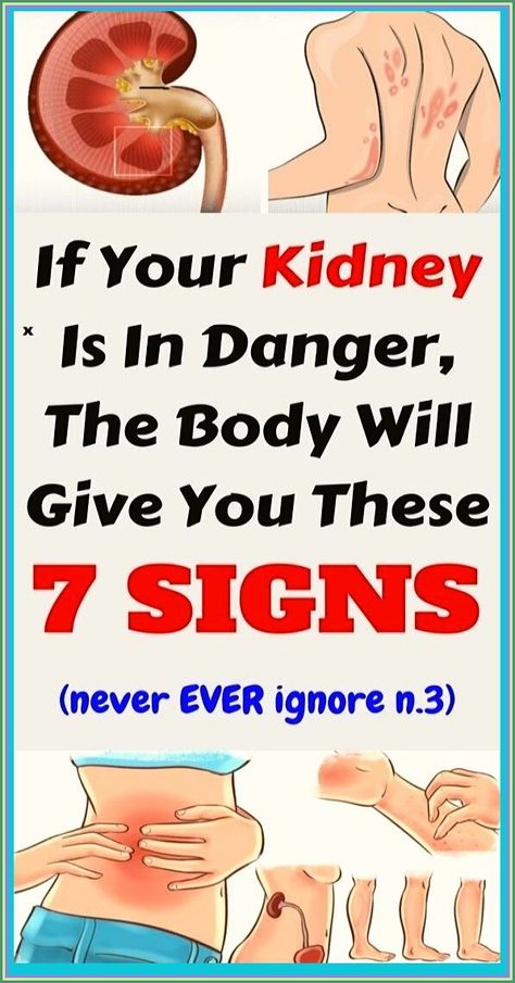 If Your Kidneys Are In Danger, Your Body Will Give You These 7 Signs Womens Health Care, Kidney Health, Health Facts, Healthy Tips, Holistic Health, Womens Health, Healthy Habits, Home Remedies, Baking Soda