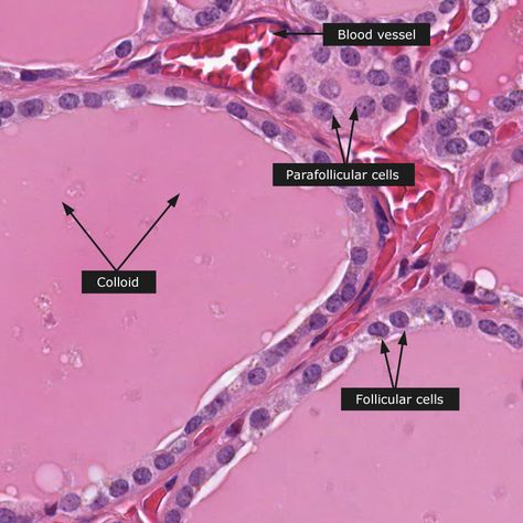 Normal: Thyroid gland Tissue Biology, Medical Terminology Study, Microscopic Photography, Medicine Notes, Vet Medicine, Medical Student Study, Medicine Student, Medical School Motivation, Medical Careers