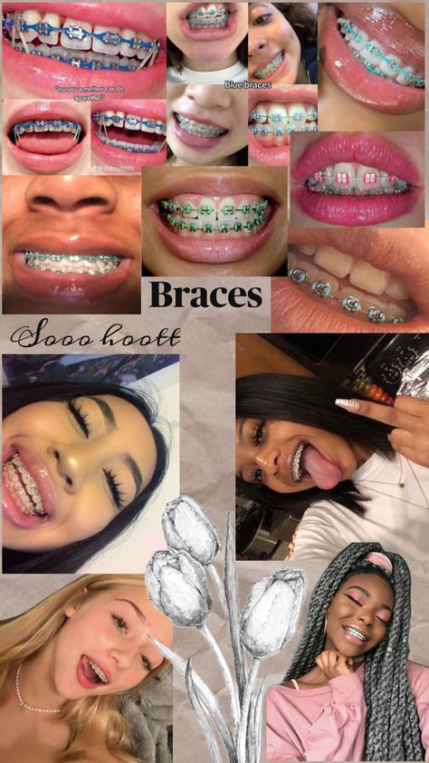 Iii loveee the pinkkk oneee😍 Braces Black Color, Braces Colors For White Teeth, Cute Braces Colors Combinations, Cute Braces Colors Aesthetic, Braces Black Women, Braces Color Combos, Braces Colors Combinations, Dental Appliance, Cute Braces Colors