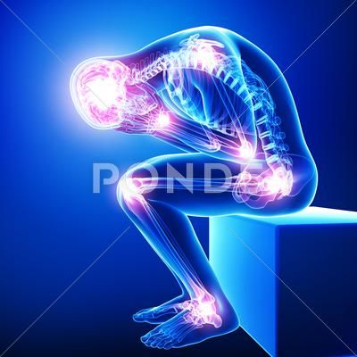 Anatomy of male brain pain with all joints pain Stock Illustration #AD ,#brain#male#Anatomy#pain Joints Pain Relief, Under My Skin, Body Pain, Shark Tank, Nerve, Physical Therapy, Chronic Pain, Back Pain, Pain Relief