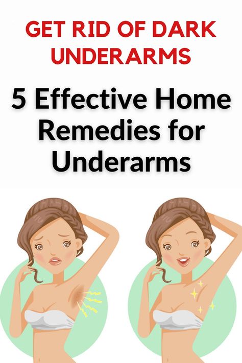 It is possible to prevent underarms darkening with natural methods. We have compiled methods for underarm whitening that are very effective and that you can easily prepare at home. Here are solutions for underarm whitening… Underarms Whitening, Rid Of Dark Underarms, How To Whiten Underarms, Unwanted Hair Permanently, Underarm Whitening, Unwanted Hair Growth, Dark Underarms, Dancer Workout, Ball Hairstyles