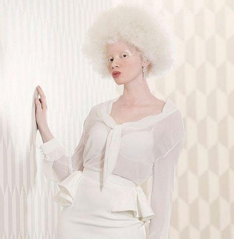 Thando Hopa, White Hair Model Woman, Albino Woman Art, Fashion Diversity, Youngest Sibling, Pretty Albino Girl, Albino And Black Model, Red Armor, Albino Girl