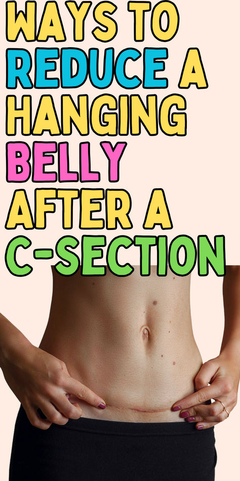 Discover practical tips and effective exercises to help reduce your C-section shelf or belly pooch. These strategies focus on strengthening your core, improving posture, and regaining confidence postpartum. Perfect for moms looking to feel their best after childbirth! Postpartum C Section Workout Plan, Postpartum Csection Exercises, Exercise Post C Section, Exercises For C Section Pooch, C Section Abdominal Workout, Exercise For C Section Moms, Postpartum Belly Loss, Postpartum Tummy Workout, Csection Pooch How To Get Rid