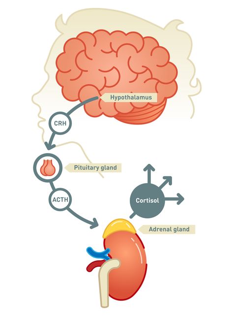 Cushing’s Syndrome, Cushings Syndrome, Reducing Cortisol Levels, Addisons Disease, Pituitary Gland, Adrenal Glands, Cortisol Levels, Adrenal Fatigue, Endocrine System