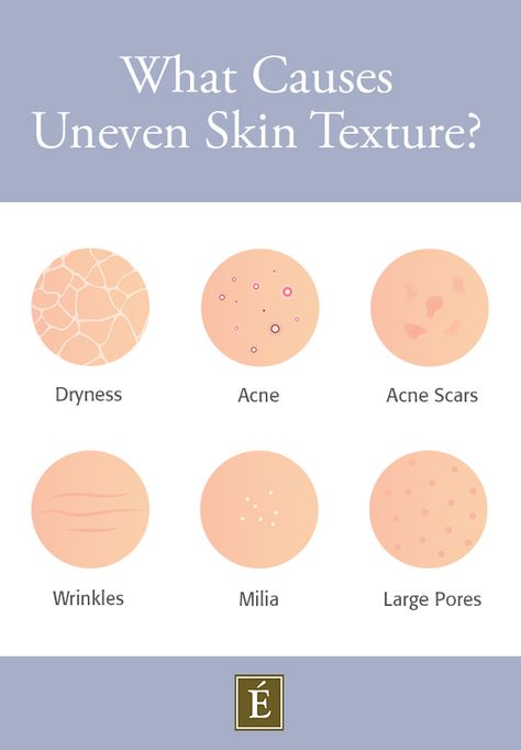 We’re all after #skin with a smooth surface, but the reality is that most of us experience uneven skin texture 😤 Learn more about what causes textured skin and how to improve it. ---- #skintexture #skincare #skincaretips How To Smooth Textured Skin, Uneven Texture Skin, Uneven Skin Texture Skincare, Smooth Skin Quotes, How To Smooth Skin, How To Improve Skin Texture, Textured Skin Routine, Skincare For Textured Skin, How To Get Smooth Skin