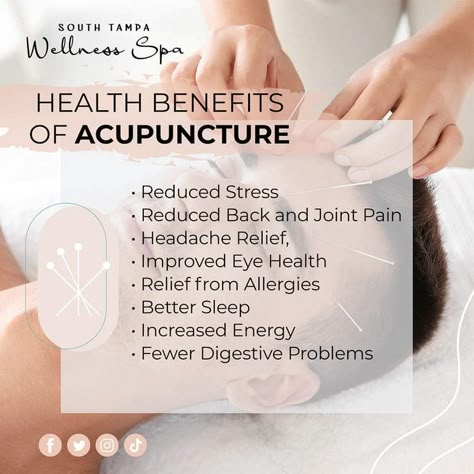 Benefits Of Acupuncture, Acupuncture Benefits Facts, Accupunture Benefits Health, Cupping Points, Therapy Marketing, Acupuncture Benefits, Acupuncture Clinic, Improve Nutrition, Acupressure Mat