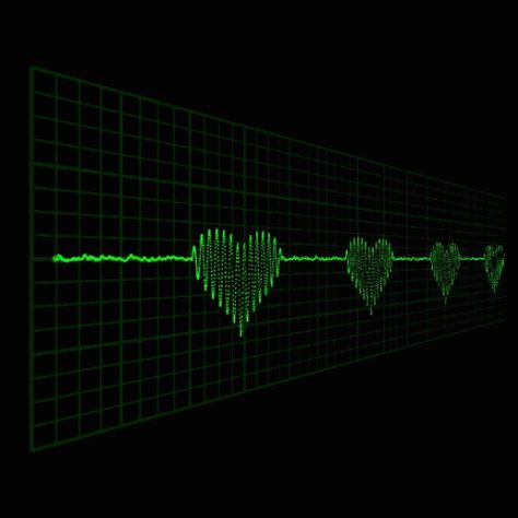 Heart Overlay, Heart Monitor, Heart Banner, Animation Gif, Free Overlays, Heart Gif, Banner Gif, Heart Beat, Beautiful Gif