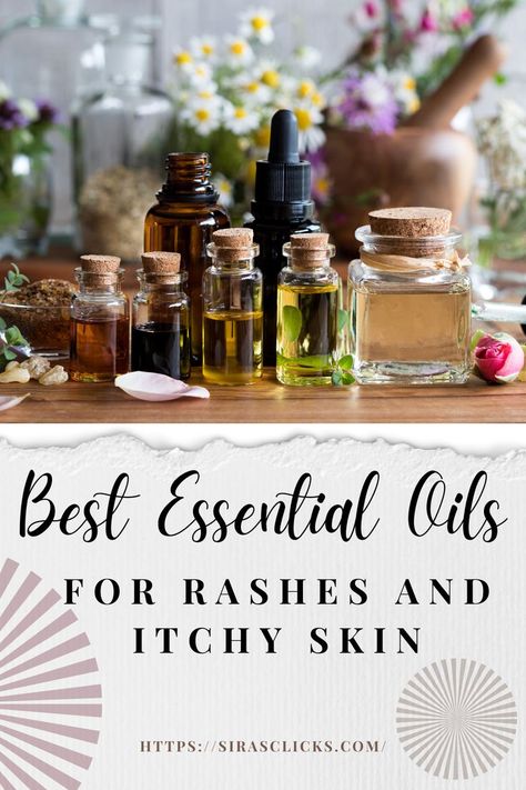 Essential Oils For Rash, Topical Essential Oils, Home Remedies For Skin, Skin Rashes, Homemade Essential Oil, Itching Skin, Essential Oils Guide, Oil Remedies, Essential Oil Blends Recipes