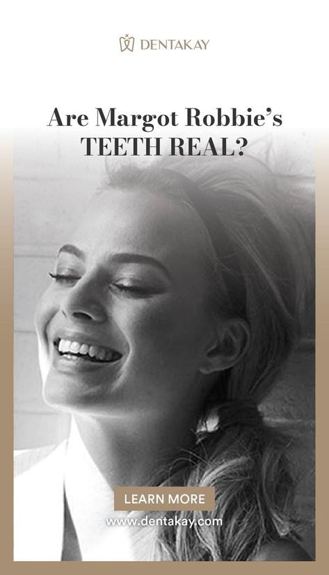 Barbie Smile- Margot Robbie's Smile Barbie Margot Robbie, Smile Makeover, Margot Robbie, Cool Suits, A Smile, The Truth, Wake Up, How To Find Out, Hollywood