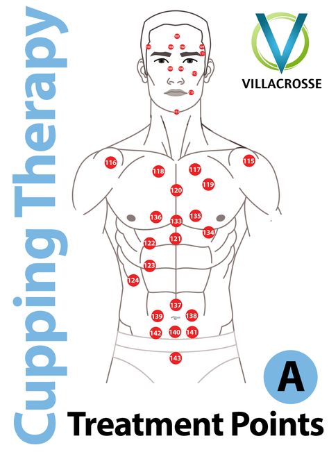 Cupping Points Cupping Placement Chart, Hijama Points, Cupping Points, Traditional Chinese Medicine Acupuncture, Chinese Cupping, Reflexology Benefits, Benefits Of Cupping, Hijama Cupping, Polarity Therapy