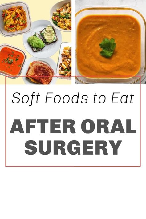 Soft Foods to Eat After Oral Surgery by Workweek Lunch | Simplifying meal prep for busy people | Serving time-strapped professionals and parents | Meal Planning and Weekly Menus. Whether you have a surgical procedure or an incredibly busy week on the horizon, planning your meals will make your life easier. Just ask the thousands of people that are a part of the Workweek Lunch Meal Prep Program! Learn More. meal ideas for recovery, soft diet meal prep, nutritious soft foods, foods after surgery Soft Food Ideas After Dental Work, Soft Foods To Eat After Dental Surgery, Soft Foods For Dental Work, Best Soft Foods, Soft Foods To Eat, Meal Planning Weekly, Soft Diet, Soft Foods Diet, Vegan Butternut Squash Soup