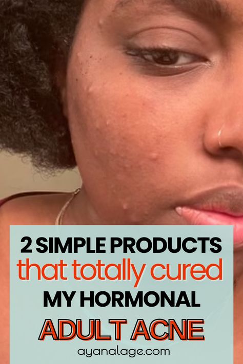 Skin Care Routine For Hormonal Acne, Under Skin Acne, Hormonal Acne Skincare Routine, Hormonal Acne Skincare, Comedonal Acne, Hormonal Acne Remedies, Skincare Routine Tips, Cystic Acne Remedies, Skin Supplements