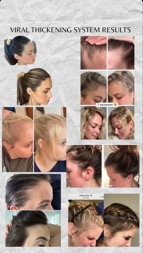 Ir Clinical Monat, Monat Before And After, Before And After Hair, Monat Hair, Hair Transformation, Hair Care, Hair, Beauty, Quick Saves