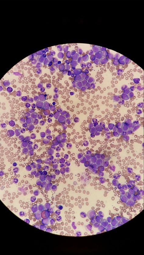 Hematology Aesthetic, Histology Aesthetic, Cells Aesthetic, Microscope Aesthetic, Cell Lab, Microbiology Aesthetic, Biotechnology Aesthetic, Cell Aesthetic, Medical Lab Scientist