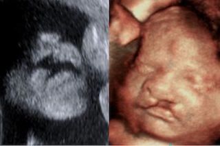 4d Ultrasound Pictures, 3d Ultrasound Pictures, Medical Sonography, 3d Ultrasound, 4d Ultrasound, Diagnostic Medical Sonography, Baby Ultrasound, Cleft Lip, Ultrasound Pictures