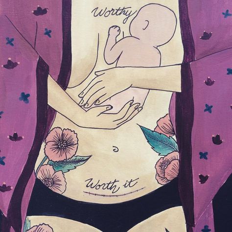 C Section Tattoo Ideas, C Section Scar Tattoo, Breastfeeding Art, Doula Gifts, Birth Art, Pregnancy Art, Birth Doula, Mother Tattoos, Mother Art