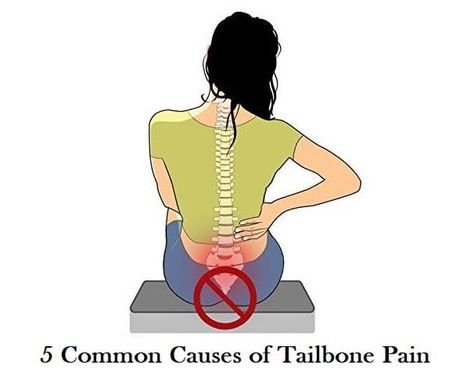 5 Common Causes of Tailbone Pain - Inspiring MeMe® Tailbone Pain Relief, Senior Assisted Living, Tailbone Pain, Donut Pillow, Poor Posture, Senior Care, Senior Living, Health Articles, Wellness Tips