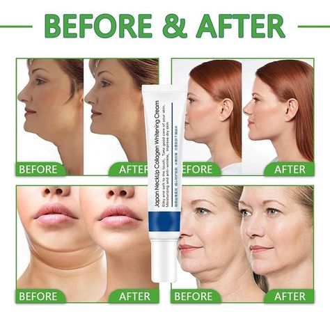 ——-Check out our HOT SALE——- Collagen Neck Cream Anti-aging Brightening Whitening Firming Lifting Neck Chin Moisturizing Reducing Fine Lines New Skincare Get it Here 👇👇 https://getnsale.com/collagen-neck-cream-anti-aging-brightening-whitening-firming-lifting-neck-chin-moisturizing-reducing-fine-lines-new-skincare/ ———- Like 💖💖 & Share ♻️👩‍👩‍👦‍👦 ————- #skincare #beauty #skincareroutine #makeup #skin #skincareproducts #selfcare #skincaretips #antiaging #glowingskin #love #cosmetics #facial #h... Eelhoe Collagen, Korean Skin Care Products, Fine Wrinkles, Korean Skin Care, Brightening Cream, Korean Skin, Neck Cream, Aloe Vera Extract, Double Chin