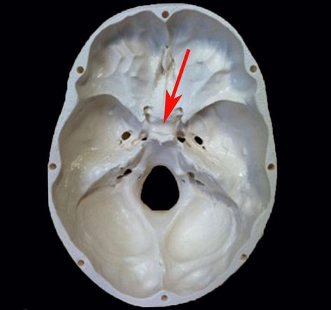 Sella turcica Sphenoid Bone, Axial Skeleton, Body Bones, Skull Anatomy, Craniosacral Therapy, Pituitary Gland, Anatomy And Physiology, Human Anatomy, Medical Care