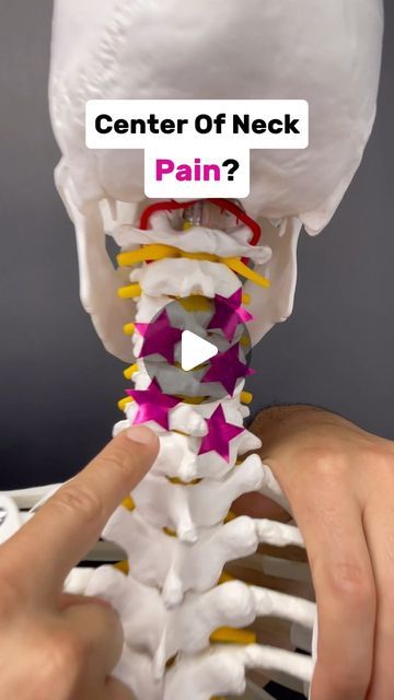 Dr. Joe Damiani - TMJ, Head & Neck Specialist on Instagram: "Comment the word ‘NECK’ on this post if you need help getting rid of Neck Pain for good.

Do you experience neck pain that persists on the center of the neck? This can happen if you are unable to maintain your cervical spine in an upright position.

One key muscle group that pulls the neck into an upright posture are the Deep Neck Flexors!  They attach to the FRONT of the cervical vertebrae (AKA Neck) and facilitate stabilization.

In this video I show a test that can determine if these muscles are weak on you.  If the test is positive AKA the muscles are weak.  I have also included an exercise to begin building strength.  Test yourself and start getting stronger!

#neckpain #neckpainrelief #neckpaintreatment #pinchednerve #cervi Pulled Muscle In Neck, Neck Decompression, Neck Muscle Exercises, Cervical Spine Exercises, Cervical Pain Exercises, Neck Pain Relief Stretches, Neck Muscle Anatomy, Upright Posture, Muscles Of The Neck