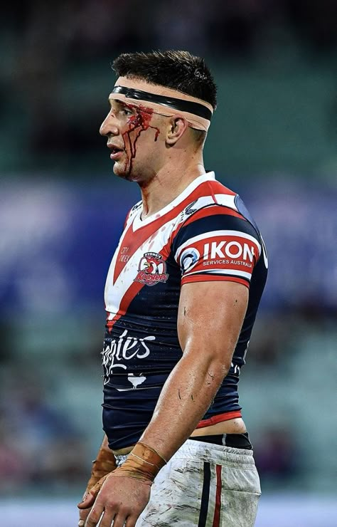 Rugby Injuries, Rugby Motivation, Rugby Aesthetic, Sydney Roosters, Rugby Men, Street Dogs, Blood Sweat And Tears, Sports Injury, Rugby Players