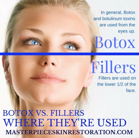 Botox vs. Fillers | Which Will Work Best for YOU? [Free Infographic] | They sound scary when you're new to medical skincare. Our post will help you find the best one for you! #Botox #Fillers #whatdofillersdo #whatdoesBotoxdo #MasterpieceSkinRestoration #hyaluronicacid Botox Vs Fillers, Winter Skincare Products, Medical Skincare, Restylane Lyft, Skin Face Care, Paula's Choice Skincare, Sunscreen For Face, Antiaging Skincare, The Best Skin Care Products