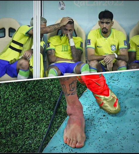 Neymar Injury, Football Injury, Black Vibe, Brazil Team, Neymar Football, Messi And Neymar, Ankle Injury, Medical Staff, Football Wallpaper