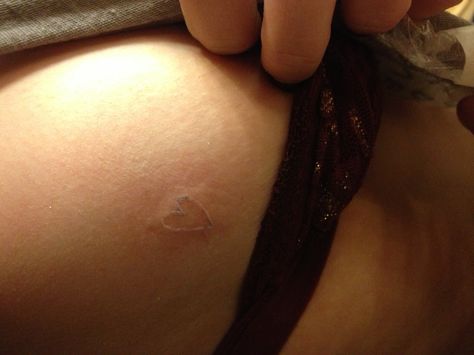 Glute Tattoo, Heat Tattoo, Tattoo White Ink, Bandage Tattoo, Neat Tattoos, Tattoo White, White Tattoos, White Heat, Jewelry Tattoo