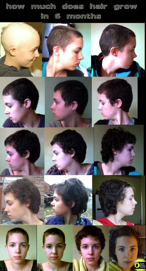 Why shaved the hair? http://earthreview.eu/2012/02/girls-dare-to-shave-their-heads/ Hair Growth After Chemo, Buzzed Hair Women, Shaved Hair Women, Growing Out Hair, Girls With Shaved Heads, Chemo Hair, Buzzed Hair, Short Sassy Hair, Girl Braids