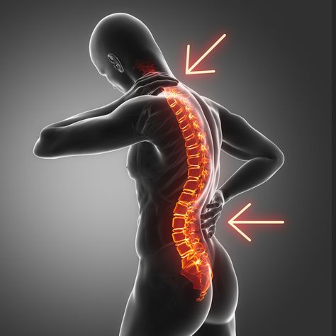 Types of Spine Curvature Disorders - Spine Institute of Arizona Lumbar Lordosis, Body Aches, Spine Surgery, Primary Care Physician, Body Ache, Poor Posture, Medical Knowledge, Young Professional, Natural Curves