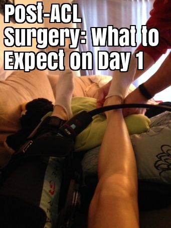 I have been waiting 5 days to write this post. 5 days! I wanted to write about my ACL experience for anyone else that will have to go through this surgery in the future, so that they know what the expect and to plan for. However, I was not anticipating how out of it I … Acl Recovery Timeline, Torn Acl Exercises, Post Acl Surgery, Meniscus Surgery Recovery, Acl Tear Recovery, Acl Surgery Recovery, Knee Meniscus, Meniscus Surgery, Yoga For Knees