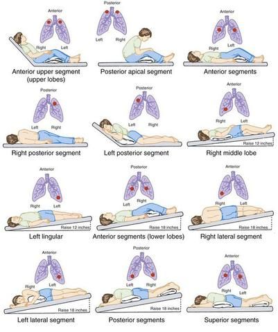 16 Mucus Clearing Techniques That Alleviate Shortness of Breath Postural Drainage, Physical Therapy Student, Basic Anatomy And Physiology, Nursing School Survival, Pulmonology, Respiratory Care, Respiratory Therapy, Lungs Health, Medical School Studying