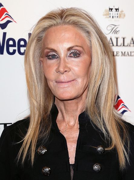 Joan Van Ark, Joan Of Arc Film, The Passion Of Joan Of Arc 1928, Knots Landing, Plastic Surgery, Then And Now, Van, Beauty