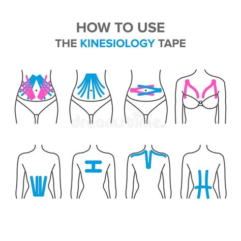 Physio Tape, K Tape, Kinesio Tape, Kt Tape, Kinesio Taping, Physical Therapy Exercises, Kinesiology Taping, Iv Therapy, Muscle Anatomy