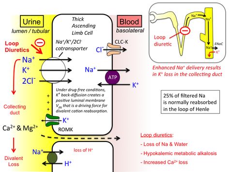 diuretic_pharm [TUSOM | Pharmwiki] Edema Causes, Loop Of Henle, Metabolic Alkalosis, Metabolic Acidosis, Intracranial Pressure, Chronic Lung Disease, Sms Language, Naturopathic Medicine, Nursing School Studying