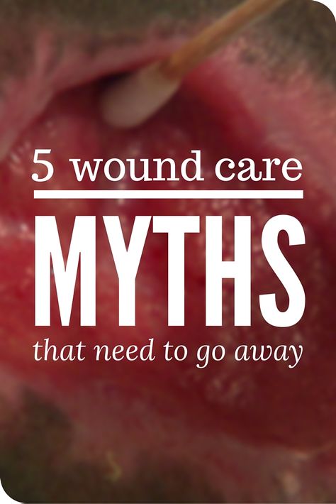 We’re thrilled to see many outdated notions and practices go by the wayside, but there are still some wound care myths out there that just refuse to die. Here are five of the most frequent incorrect statements we still hear out in the field. Wound Care Nursing Education, Wound Nurse, Natural Wound Care, Wound Management, Wound Care Nurse, Hospice Nursing, Wound Care Nursing, Home Health Nurse, Community Nursing