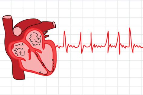 Afib Atrial Fibrillation, Normal Sinus Rhythm, Cardiac Rhythms, Atrial Fibrillation, Coronary Arteries, Vagus Nerve, Aerobic Exercise, Low Impact Workout, Heart Health