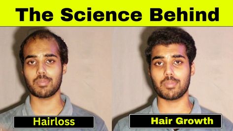 Mens Hair Care, Grow Hair, 00 00, The Science, For Hair, Hair Growth, Mens Hairstyles, Hair Hair, Hair Care