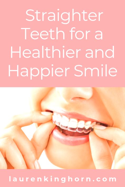 Ever considered having your teeth straightened? Here's how to go about it nowadays and why it's a good idea. #straighterteeth #healthysmile #happysmile #selfcare Teeth Straight, Diy Teeth, Cleaning Your Colon, Traditional Braces, Clear Braces, Loose Tooth, Diy Teething, Teeth Straightening, Straight Teeth