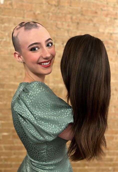 Wigs For White Women, Alopecia Photography, Alopecia Artwork, Bald Women Photography, Shaved Head Women Growing Out, Alopecia Wig, Alopecia Hairstyles, Androgenetic Alopecia, Bald Head Women