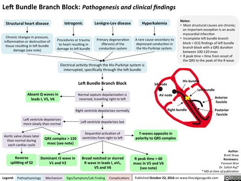 Left Bundle Branch Block, Cardiology Study, Nursing Cardiac, Thoracic Surgery, Bundle Branch Block, Concept Maps, Nurse Practitioner School, Cardiac Rhythms, Cna Nurse