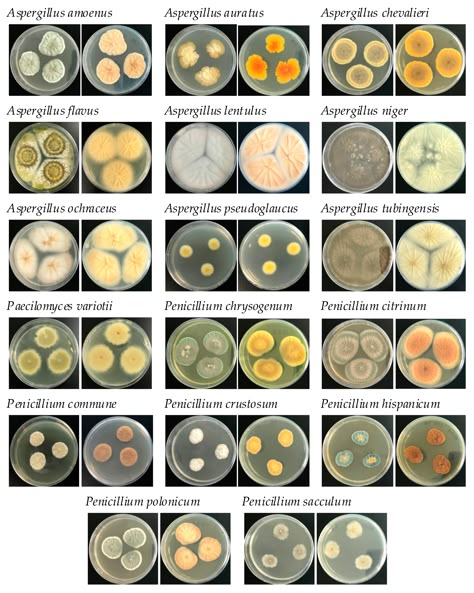 Mycology Lab, Medical Internship, Microbiology Study, Medical Laboratory Science Student, Medical Lab Technician, Microbiology Lab, Laboratory Scientist, Medical Laboratory Scientist, Lab Science